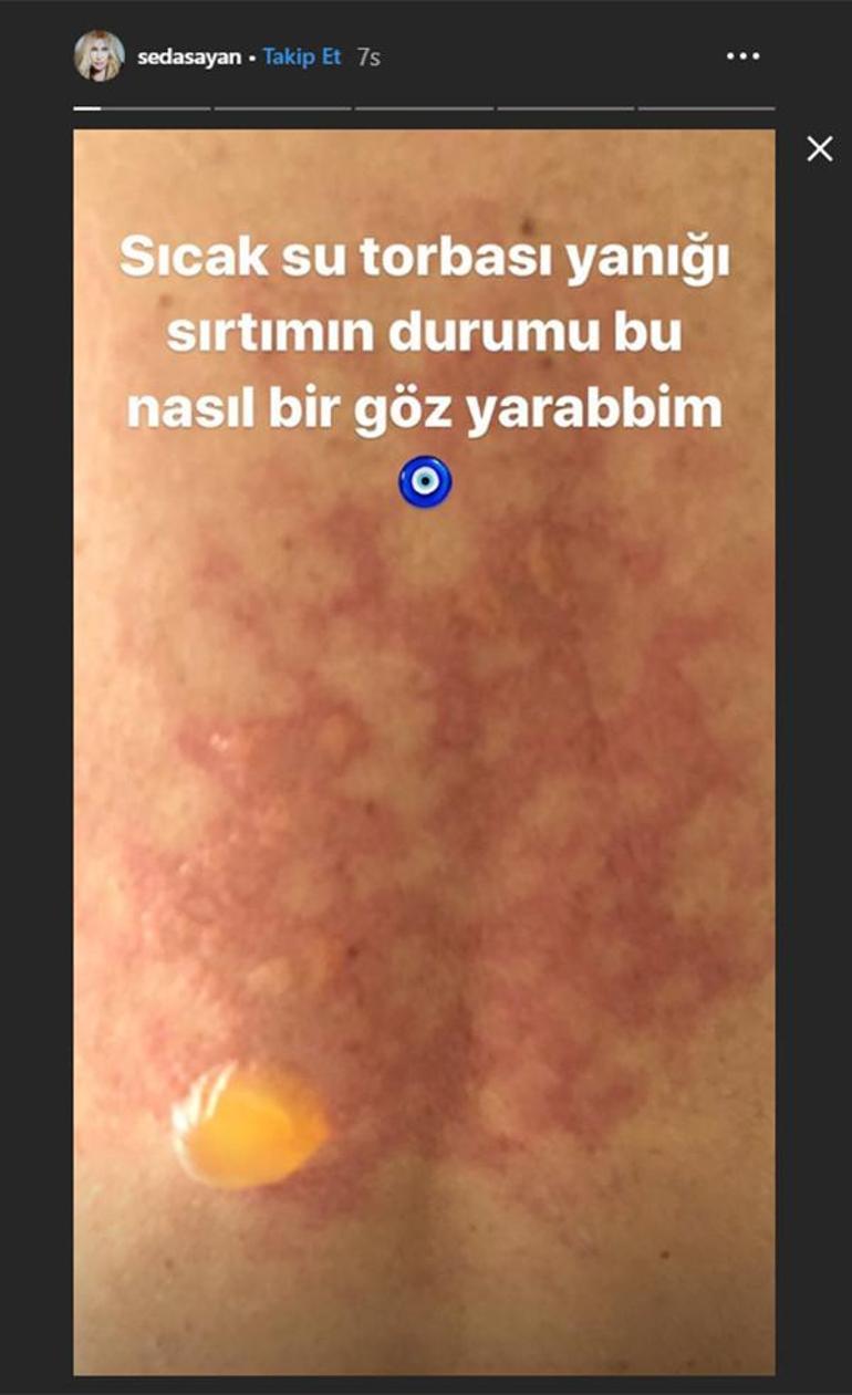 Seda Sayan hayranlarını korkuttu Hastanelik oldu