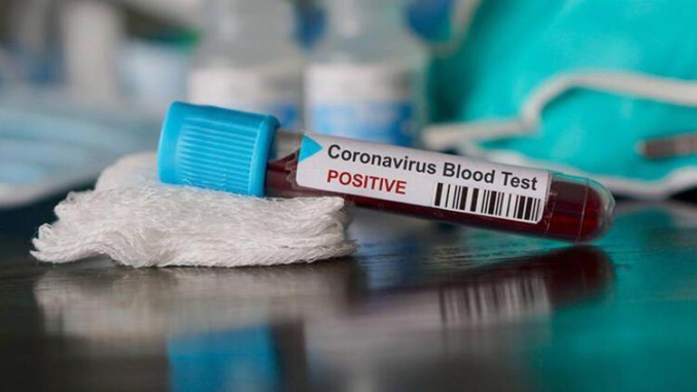 Coronavirüs riski sülükte de var İşte detaylar...