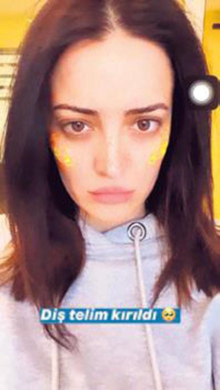 İrem Sakın diş teli kırıldı