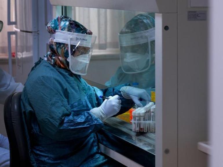 Corona virüsle mücadelede en kritik isimlerden... 300 hasta