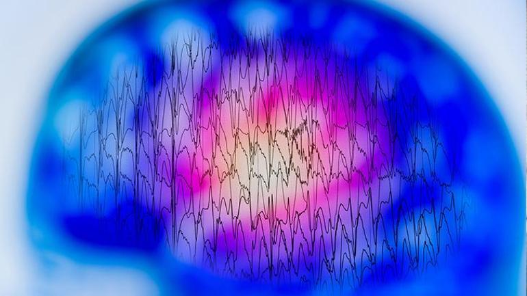 Corona virüs epilepsi hastalarını etkiler mi Epilepsi nöbeti Covid-19 belirtisi mi