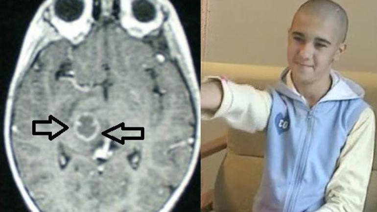 Pilli bebek, Pelin’in 16 yılda 6 kez beyin pili değişti
