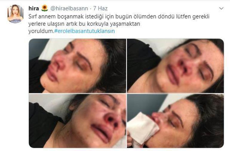 “‘Ya babam annemi öldürürse’ korkusuyla büyüdüm”