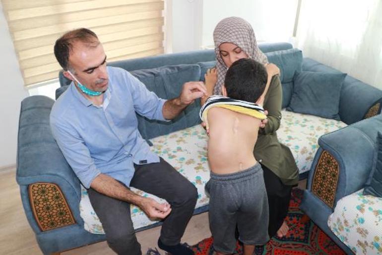 6 yaşındaki Cihan, ameliyat olamazsa felç kalacak