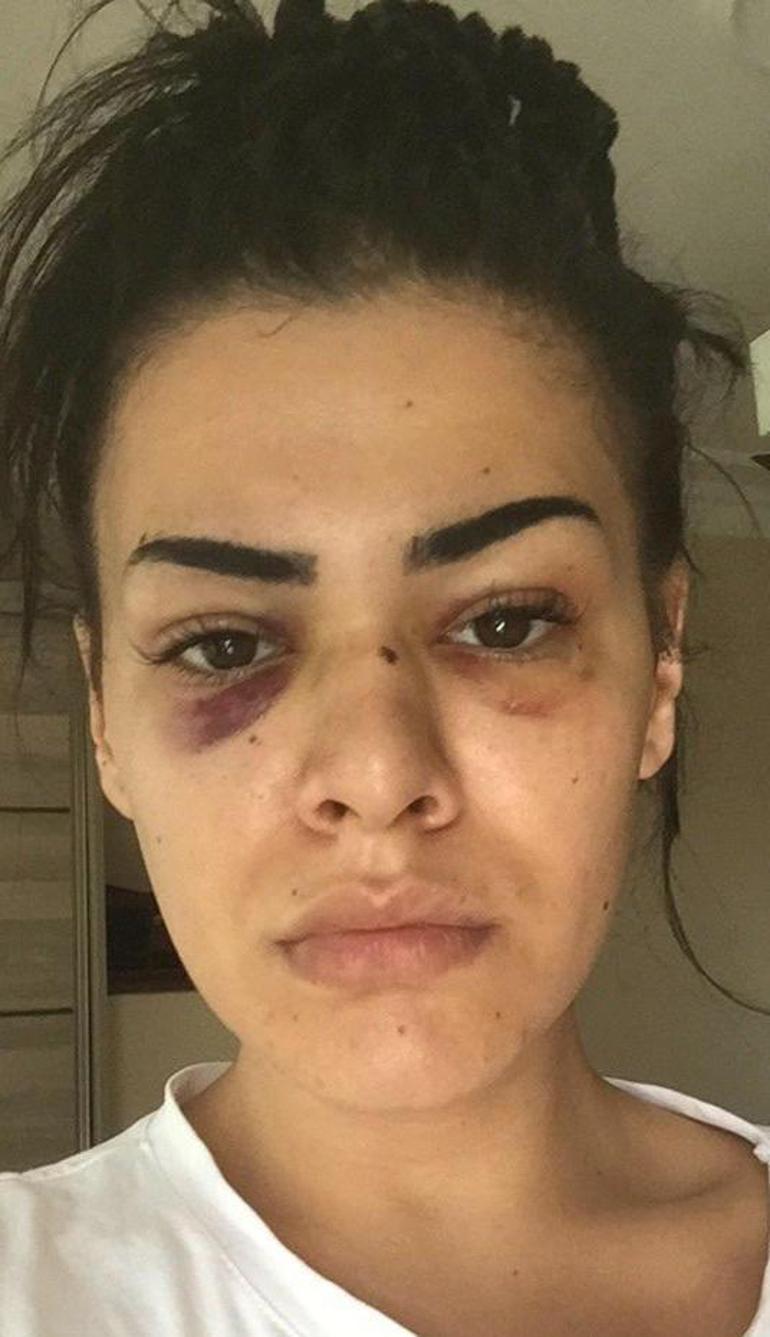 Bostancıda kadını darp eden 2 şüpheli yakalandı