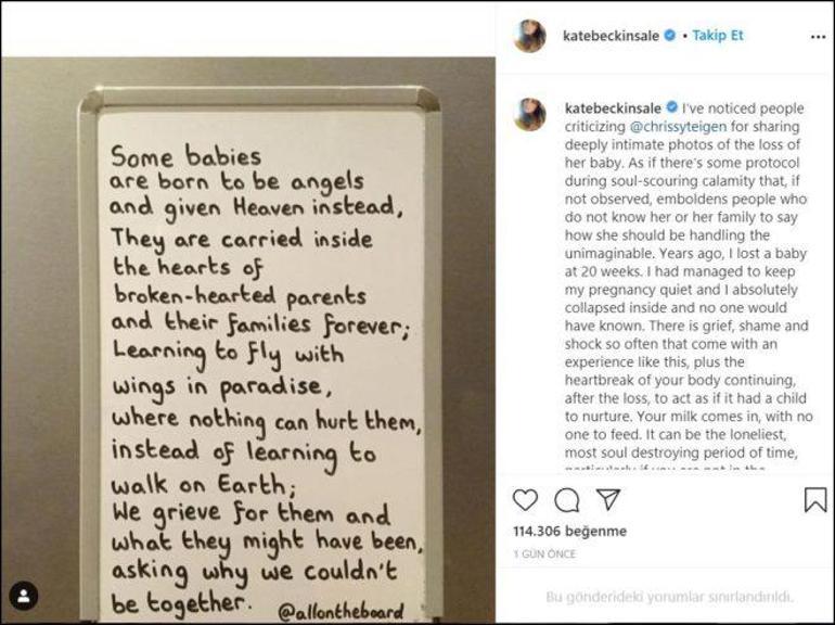 Kate Beckinsale: Yıllar önce bebeğimi kaybettim
