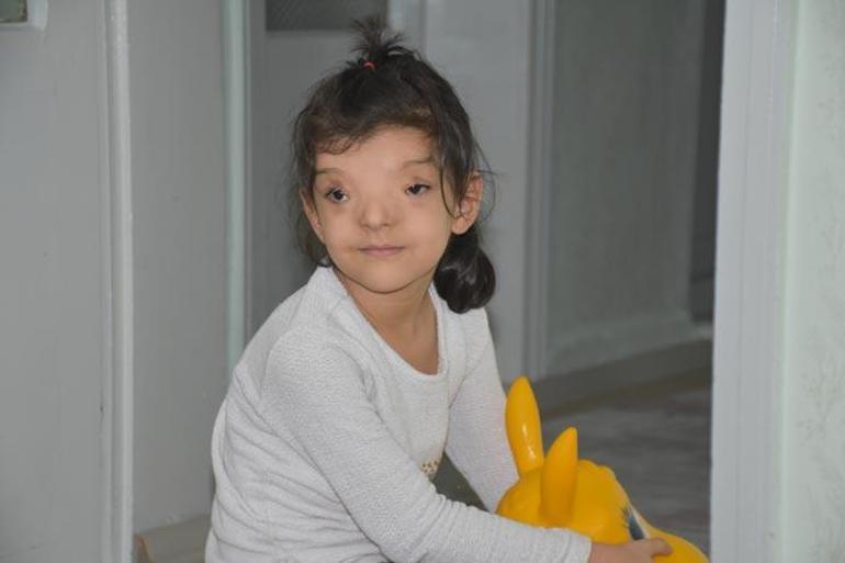 Dünyada sadece 4 ailede görülüyor Ayşenur yardım bekliyor