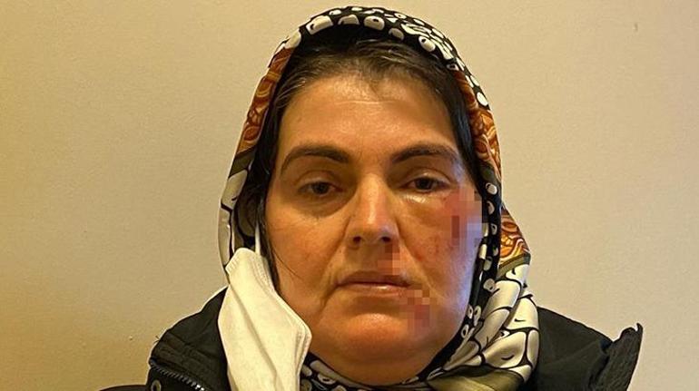 Korkunç olay Sokak ortasında tanımadığı kişinin saldırısına uğradı