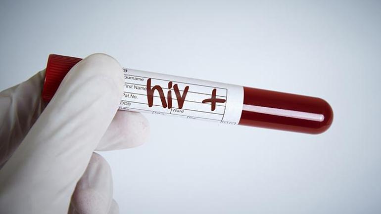 1 Aralık Dünya AIDS günü: Türkiyede 26 bin 164 HIVli hasta var