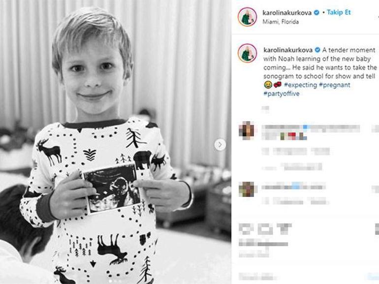 Karolina Kurkova hamile olduğunu duyurdu