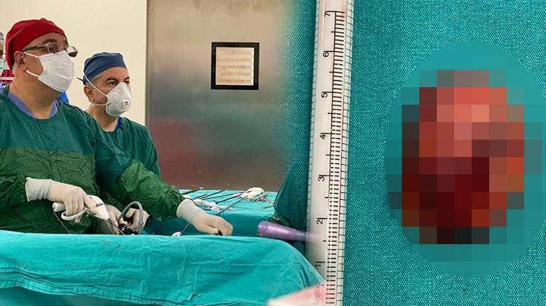 Doktorlar bile şaşırdı Baş ağrısı ve tansiyonun nedeni tümör çıktı