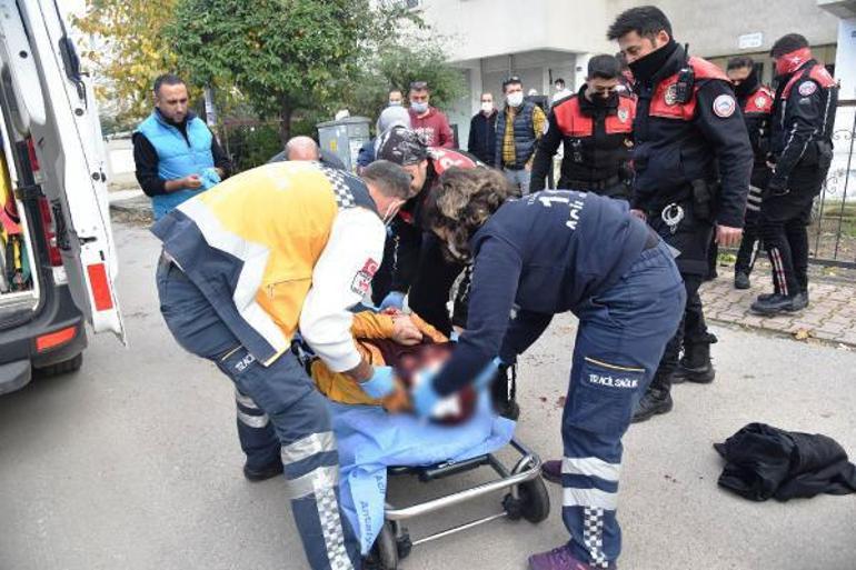 Damadını bu hale getirdi  Kayınpedere ömür boyu hapis istendi