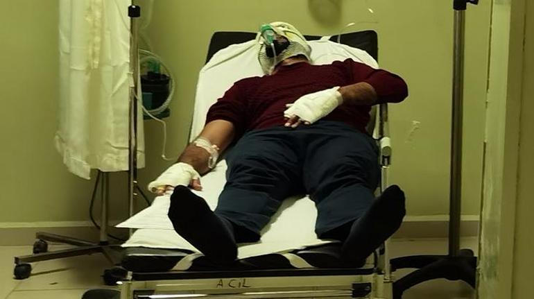 Her şey bir anda oldu Bursada iki arkadaş böyle yandı