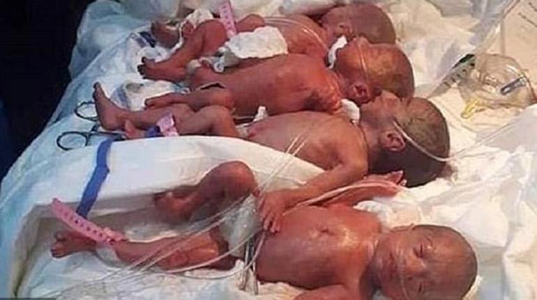 Son dakika: Doktorlar inanamadı 25 yaşındaki kadın 9 bebek doğurdu...