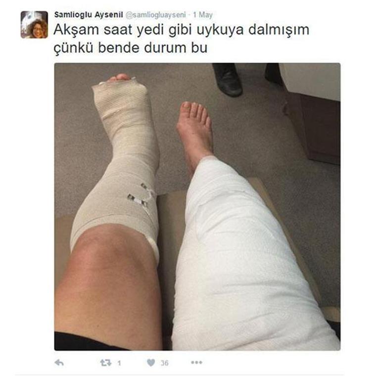 Ayşenil Şamlıoğlu sette ayağını kırdı