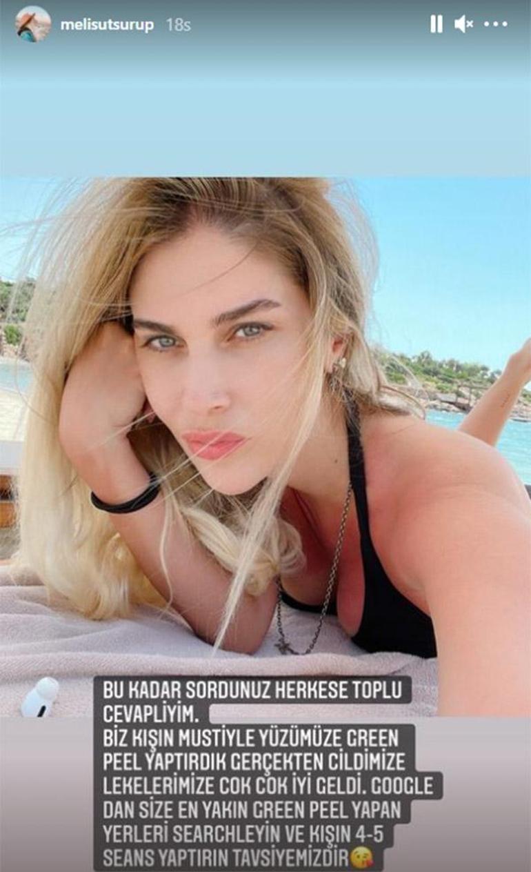 Melis Sütşurup, Mustafa Sandalla bakım yaptırmış