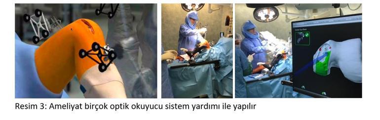 Robot yardımlı kısmi (parsiyel) diz protezi ameliyatı nedir