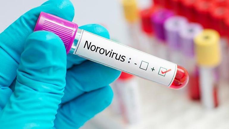 Norovirüse karşı bu belirtilere dikkat Koronavirüsten bile güçlü, hızla yayılıyor
