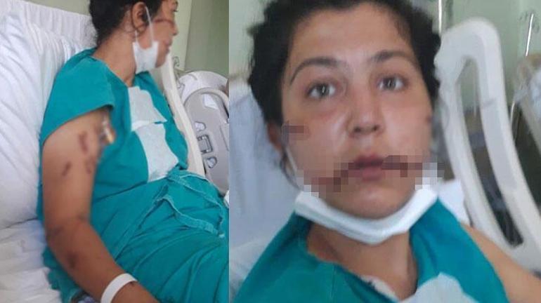 104 yerinden bıçakladığı çocuğunun annesi can çekişirken başında sigara içti