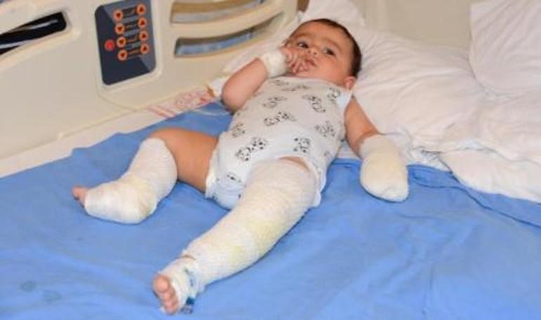 Odada bırakılan çaydanlık 10 aylık bebeğin üzerine devrildi