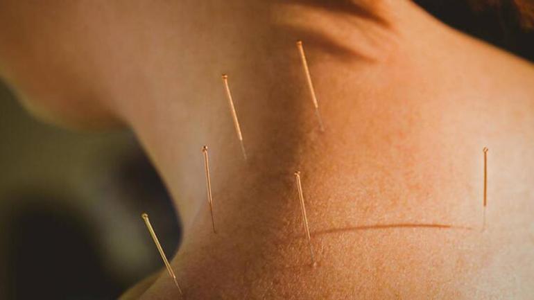 Boyun ağrısı için akupunktur yaptırdı, akciğeri delindi Suçlu kim