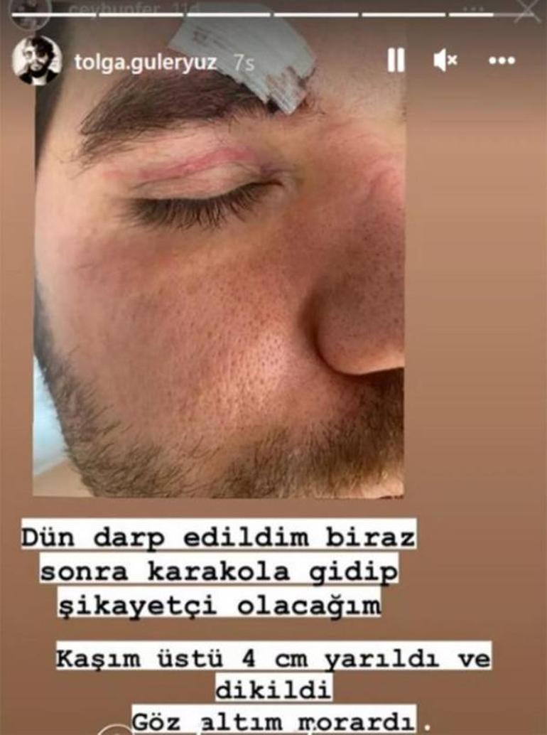 Gittiği mekanda saldırıya uğrayan Ceyhun Fersoyun kaşı yarıldı