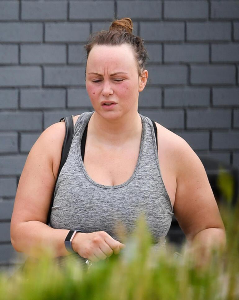 Chanelle Hayes saç ektirdi: Kendimden nefret eder hale gelmiştim