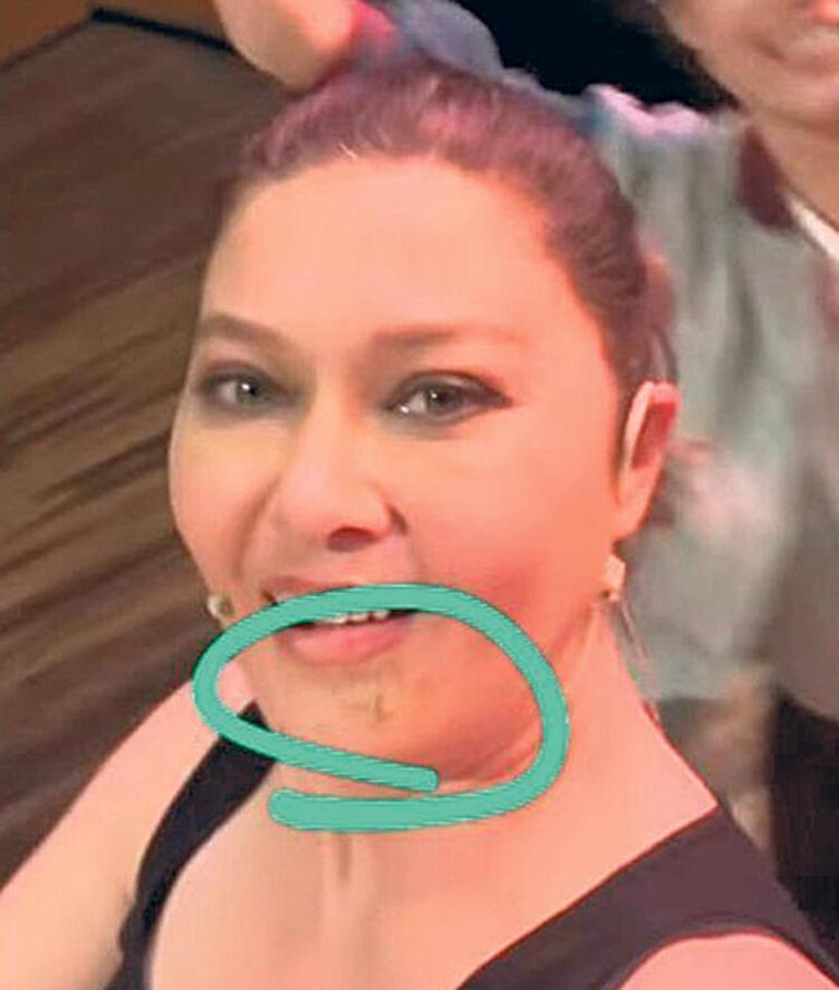 Nurgül Yeşilçay sosyal medyadan duyurdu: Büyük bir kaza atlattım