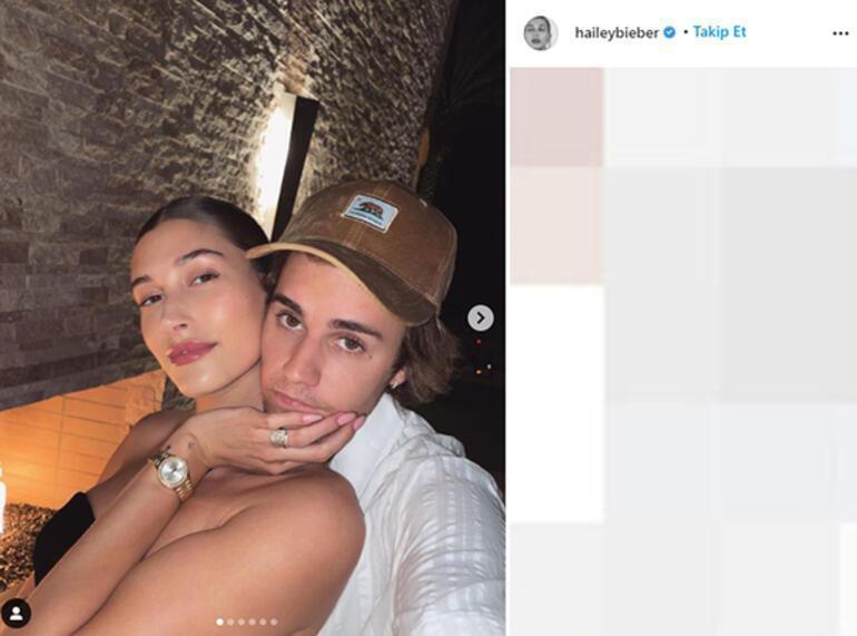 Hailey Baldwin felç belirtileri gösterdi Apar topar hastaneye kaldırıldı