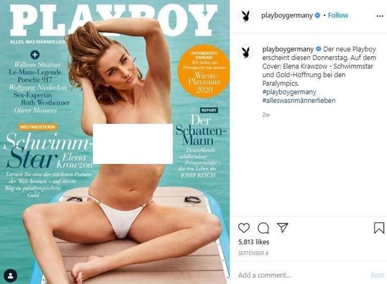 Olimpiyat ikincisi Elena Krawzow, kemoterapi sonrası son halini paylaştı Playboya kapak olmuştu