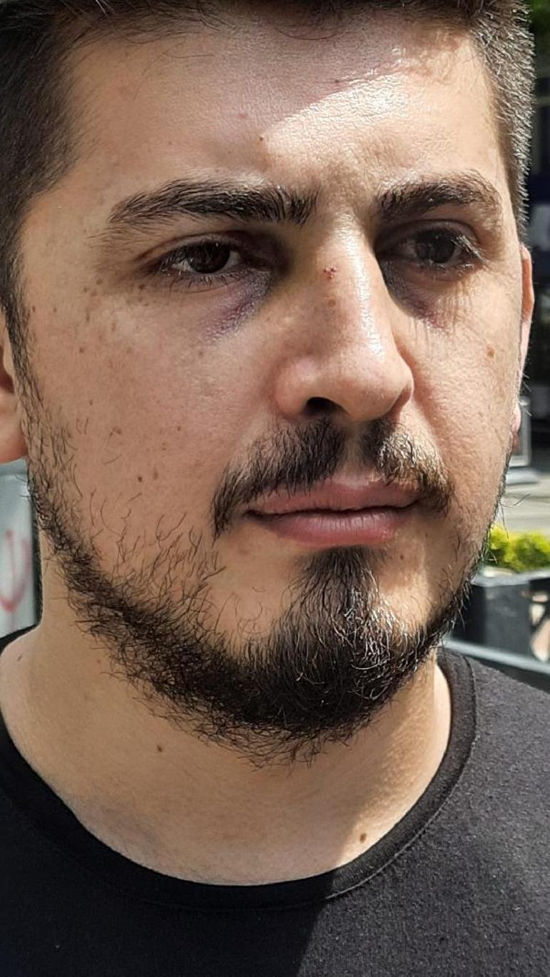 Hastanede hemşirenin burnunu kırdı, adli kontrolle serbest kaldı