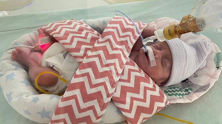 540 gramlık parmak bebek Rabiayı kök hücre tedavisi hayata bağladı