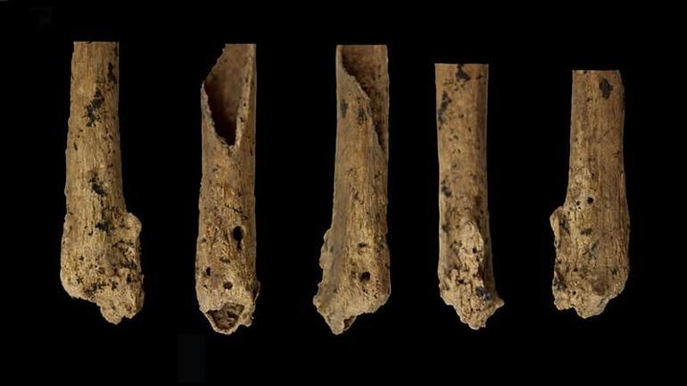 Tıp tarihini aydınlatan keşif... İlk kez 31 bin yıl önce yapılmış