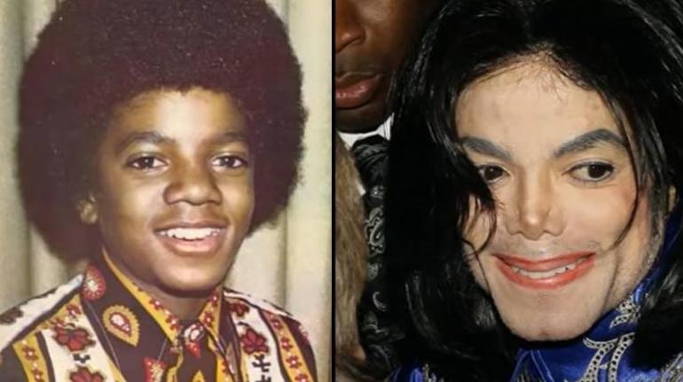 Otopsi raporunda da çıkmıştı Micheal Jacksonın 50 yıllık estetik sırrı
