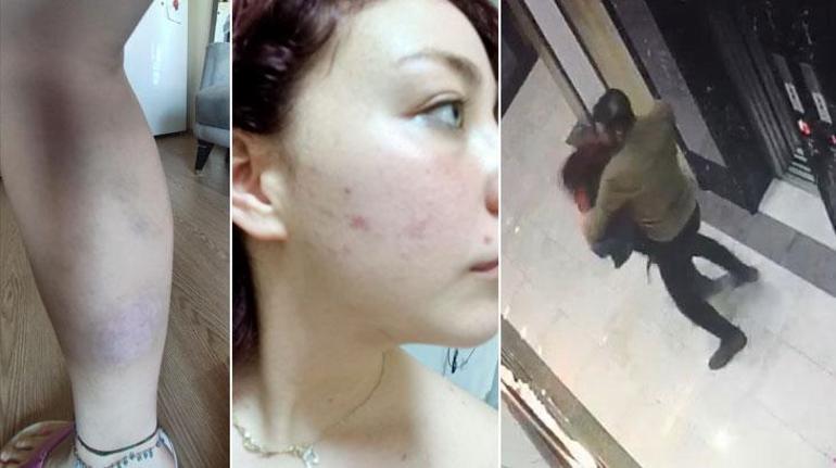 Pendik’te darp edilerek bayıltılan genç kız konuştu: 25 dakika boyunca dövdü
