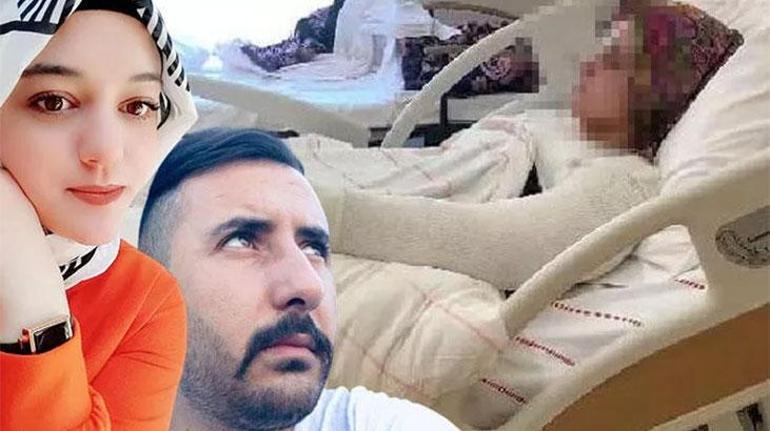 Eski nişanlısına kimyasal sıvı atan kişinin iddianamesi kabul edildi