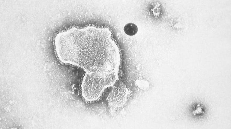 Uzmanlardan üçlü salgın uyarısı: Grip ve koronavirüsten sonra şimdi de RSV