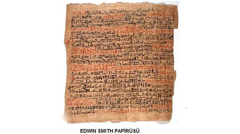Modern tıbbın şifresi bu papirüste saklı Kadavra inceleyebildikleri için geliştiler