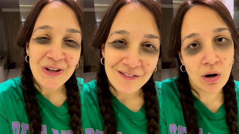Yeni anne olan Gupse Özay kendisini tiye aldı