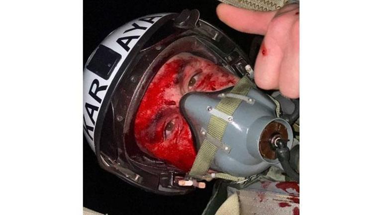 Yüzü kanlar içinde kaldı 5 İran İHAsını paramparça etti