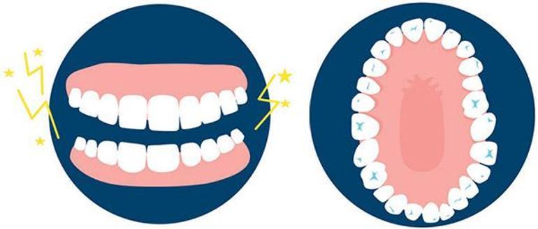 Dişlerimizi neden sıkıyoruz