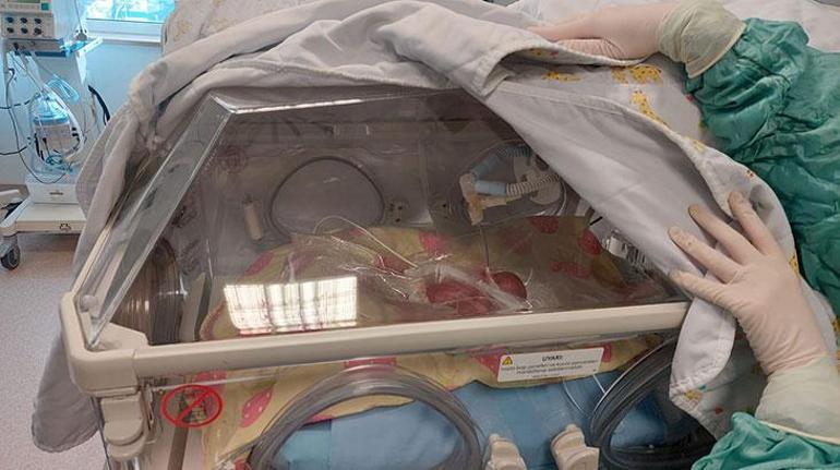 Tekirdağ’da 310 gramlık bebek doğdu