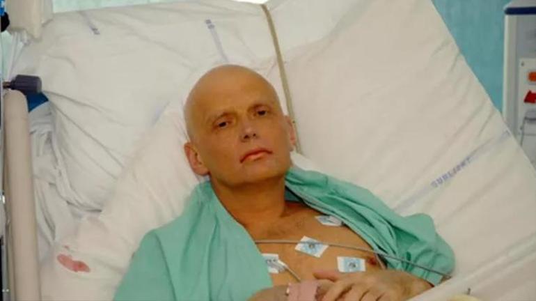 Putinin en açık sözlü düşmanı ölümün eşiğinde Kanında cıva ve arsenik bulundu