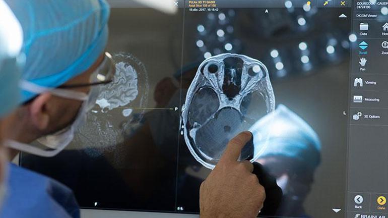 İtalyan cerrah tıp dünyasını karıştırdı Kadavradan beyin nakli yapmanın bir yolu var