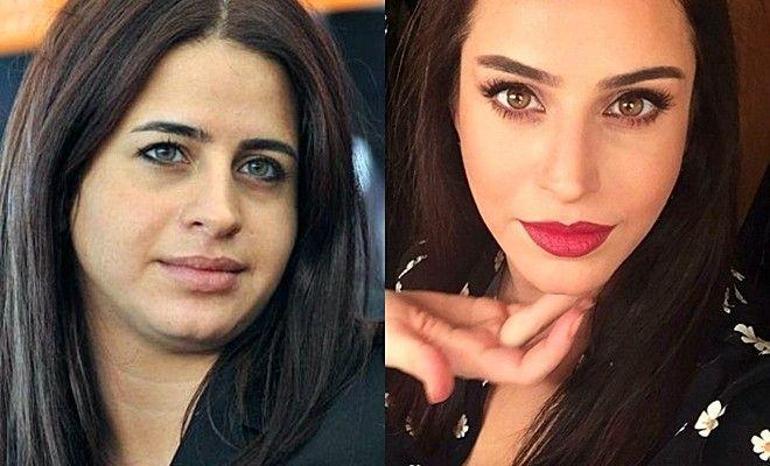 Büşra Pekinden değişim açıklaması: Yüzüm aynı yüz