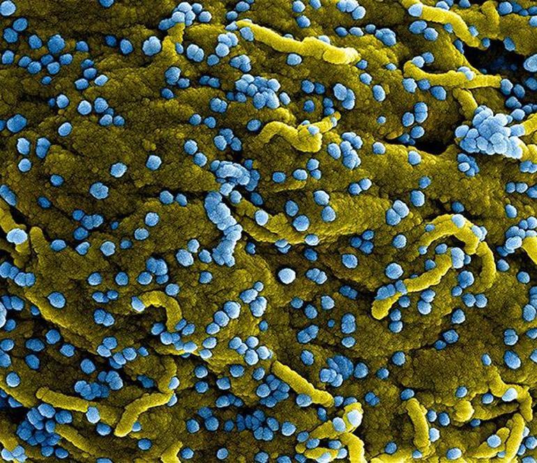 Tedavisi olmayan virüs salgına dönüştü Sekiz yeni vaka
