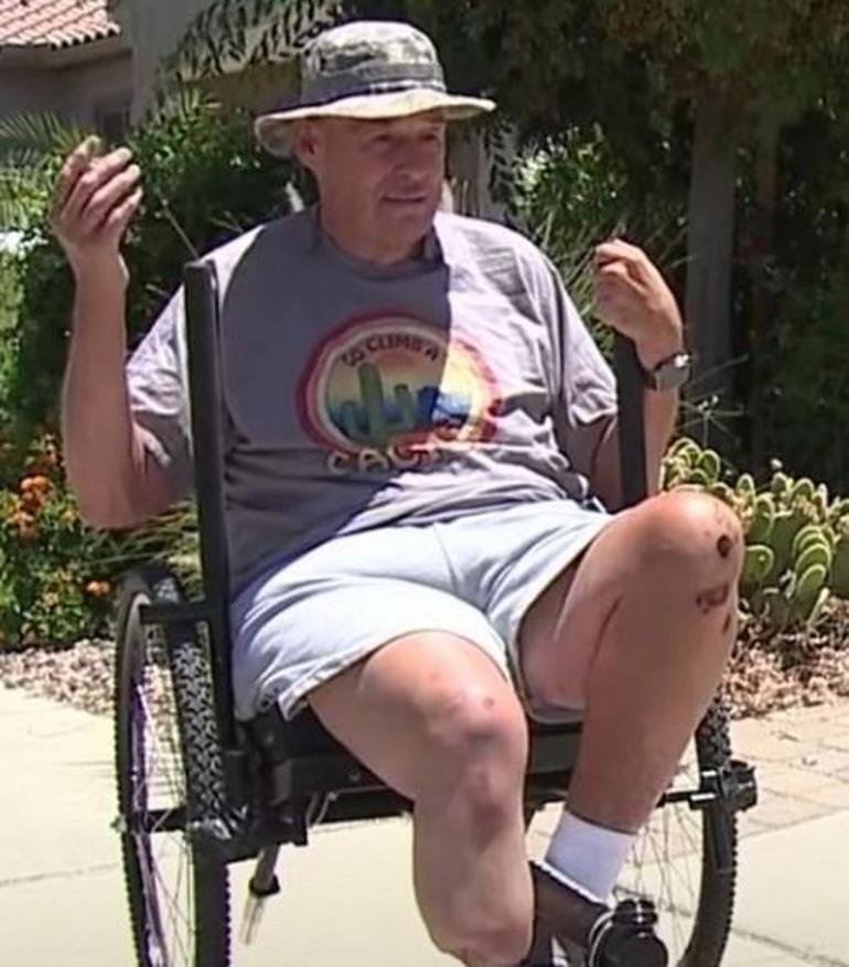 Engelli adam kabusu yaşadı Vücudundan 250 iğne çıktı