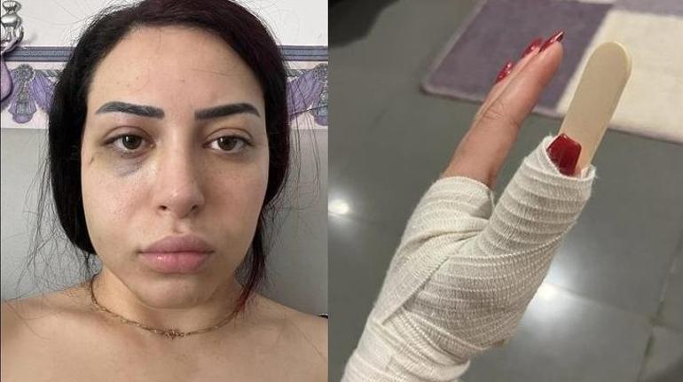 Kıbrıs Rum Kesiminde Türk kızına korkunç saldırı İşte o anlar