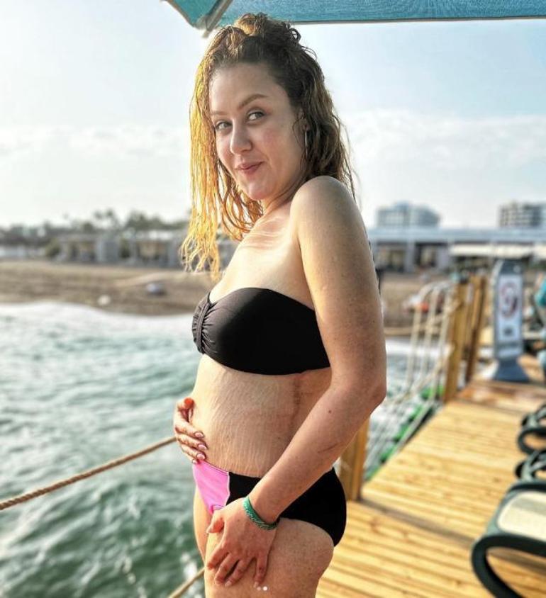 108 kilo veren Aslı Samattan bikinili poz: Çatlaklarım kendini aşmış