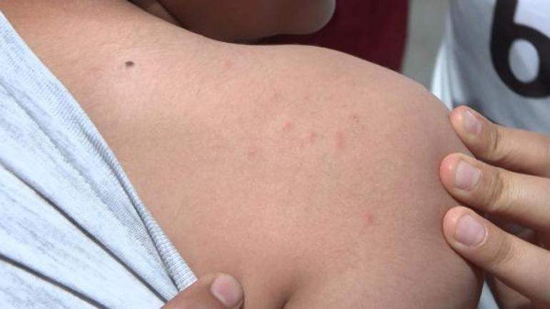 İstanbulda sivrisinek tedirginliği Çocukları dışarı çıkaramıyoruz